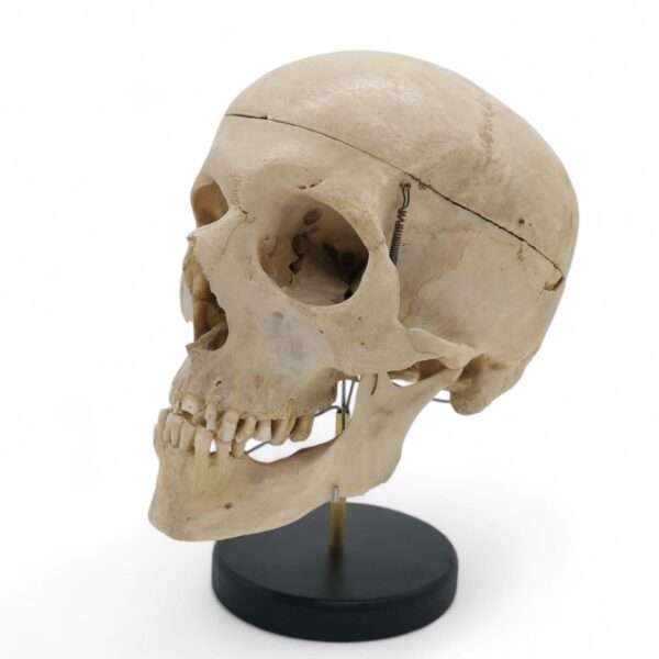 Anatomische Mensenschedel Op Standaard