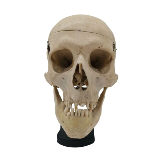 Anatomische Mensenschedel Op Standaard - Afbeelding 3